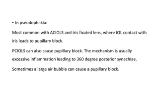 • In pseudophakia:
Most common with ACIOLS and iris fixated lens, where IOL contact with
iris leads to pupillary block.
PCIOLS can also cause pupillary block. The mechanism is usually
excessive inflammation leading to 360 degree posterior synechiae.
Sometimes a large air bubble can cause a pupillary block.
 