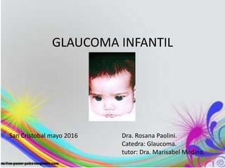GLAUCOMA INFANTIL
San Cristobal mayo 2016 Dra. Rosana Paolini.
Catedra: Glaucoma.
tutor: Dra. Marisabel Medina.
 