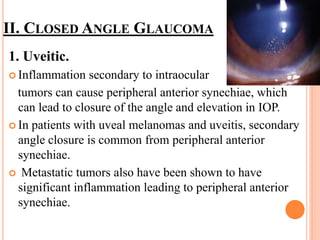 II. CLOSED ANGLE GLAUCOMA
1. Uveitic.
 Inflammation secondary to intraocular
tumors can cause peripheral anterior synechiae, which
can lead to closure of the angle and elevation in IOP.
 In patients with uveal melanomas and uveitis, secondary
angle closure is common from peripheral anterior
synechiae.
 Metastatic tumors also have been shown to have
significant inflammation leading to peripheral anterior
synechiae.
 