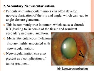 2. Secondary Neovascularization.
 Patients with intraocular tumors can often develop
neovascularization of the iris and angle, which can lead to
angle closure glaucoma.
 This is commonly true in tumors which cause a chronic
RD ,leading to ischemia of the tissue and resultant
secondary neovascularization.
 Metastatic cutaneous melanomas
also are highly associated with
neovascularization.
 Neovascularization can also
present as a complication of
tumor treatment.
 