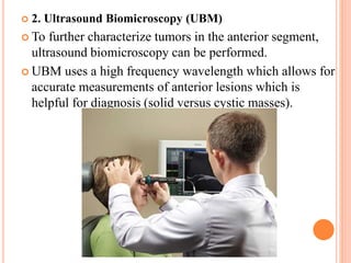  2. Ultrasound Biomicroscopy (UBM)
 To further characterize tumors in the anterior segment,
ultrasound biomicroscopy can be performed.
 UBM uses a high frequency wavelength which allows for
accurate measurements of anterior lesions which is
helpful for diagnosis (solid versus cystic masses).
 
