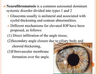  Neurofibromatosis is a common autosomal dominant
systemic disorder divided into types 1 and 2
 Glaucoma usually is unilateral and associated with
eyelid thickening and contour abnormalities.
 Different mechanisms for elevated IOP have been
proposed, as follows:
(1) Direct infiltration of the angle tissue,
(2)Secondary angle closure due to ciliary body and
choroid thickening,
(3)Fibrovascular membrane
formation over the angle.
 
