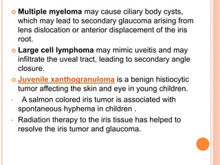  Multiple myeloma may cause ciliary body cysts,
which may lead to secondary glaucoma arising from
lens dislocation or anterior displacement of the iris
root.
 Large cell lymphoma may mimic uveitis and may
infiltrate the uveal tract, leading to secondary angle
closure.
 Juvenile xanthogranuloma is a benign histiocytic
tumor affecting the skin and eye in young children.
• A salmon colored iris tumor is associated with
spontaneous hyphema in children .
• Radiation therapy to the iris tissue has helped to
resolve the iris tumor and glaucoma.
 