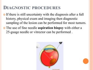 DIAGNOSTIC PROCEDURES
 If there is still uncertainty with the diagnosis after a full
history, physical exam and imaging then diagnostic
sampling of the lesion can be performed for most tumors.
 The use of fine needle aspiration biopsy with either a
25-guage needle or vitrector can be performed .
 