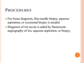 PROCEDURES
 For tissue diagnosis, fine-needle biopsy, aqueous
aspiration, or excisional biopsy is needed.
 Diagnosis of iris nevus is aided by fluorescein
angiography of iris, aqueous aspiration, or biopsy.
 