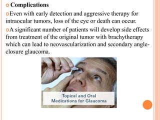  Complications
Even with early detection and aggressive therapy for
intraocular tumors, loss of the eye or death can occur.
A significant number of patients will develop side effects
from treatment of the original tumor with brachytherapy
which can lead to neovascularization and secondary angle-
closure glaucoma.
 