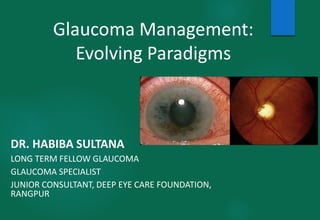 Glaucoma Management:
Evolving Paradigms
DR. HABIBA SULTANA
LONG TERM FELLOW GLAUCOMA
GLAUCOMA SPECIALIST
JUNIOR CONSULTANT, DEEP EYE CARE FOUNDATION,
RANGPUR
 