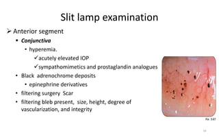Slit lamp examination
 Anterior segment
 Conjunctiva
• hyperemia.
acutely elevated IOP
sympathomimetics and prostaglandin analogues
• Black adrenochrome deposits
• epinephrine derivatives
• filtering surgery Scar
• filtering bleb present, size, height, degree of
vascularization, and integrity
16
 