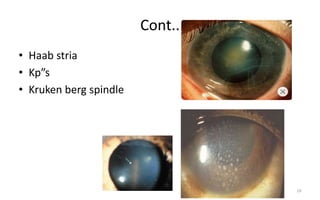 Cont..
• Haab stria
• Kp”s
• Kruken berg spindle
19
 