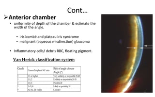Cont…
Anterior chamber
• uniformity of depth of the chamber & estimate the
width of the angle.
• Iris bombé and plateau iris syndrome
• malignant (aqueous misdirection) glaucoma
• Inflammatory cells/ debris RBC, floating pigment.
Van Herick classification system
20
 