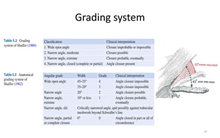 Grading system
37
 
