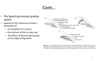 Cont…
• The Spaeth gonioscopic grading
system
• expands on this schema to include a
description of
– the peripheral iris contour,
– the insertion of the iris root, and
– the effects of dynamic gonioscopy
on the angle configuration
39
 