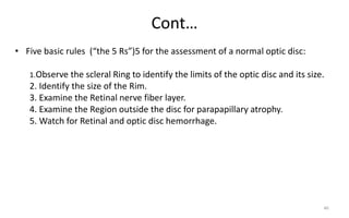 Cont…
• Five basic rules (“the 5 Rs”)5 for the assessment of a normal optic disc:
1.Observe the scleral Ring to identify the limits of the optic disc and its size.
2. Identify the size of the Rim.
3. Examine the Retinal nerve fiber layer.
4. Examine the Region outside the disc for parapapillary atrophy.
5. Watch for Retinal and optic disc hemorrhage.
46
 