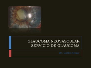 GLAUCOMA NEOVASCULARSERVICIO DE GLAUCOMA Dr. Carlos Grau. 