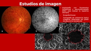 Estudios de imagen
• Angiografía con fluoresceína
intravenosa y electroretinografía
(ERG) para evaluar la isquemia
retiniana
 Ecografía B-scan
 Tomografía de coherencia óptica
Imágenes observadas por grado
de glaucoma neovascular
 