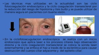 • Las técnicas mas utilizadas en la actualidad son las ciclo
fotocoagulación endoscópica y la ciclo coagulación transescleral por
la reducción del riesgo de hipotonía y tisis bulbi y se puede utilizar de
manera segura en pacientes con buena visión.
• En la ciclofotoacugulacion endoscópica se realiza con un micro
endoscopio que aplica laser a los procesos ciliares bajo observación
directa y la ciclo coagulación transescleral se coloca la sonda laser
externamente y se enfoca el haz a través de la esclerótica para causar
destrucción del cuerpo ciliar adyacente y del epitelio ciliar.
 