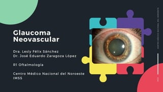 Glaucoma
Neovascular
Dra. Lesly Félix Sánchez
Dr. José Eduardo Zaragoza López
R1 Oftalmología
Centro Médico Nacional del Noroeste
IMSS
IMSSCENTROMÉDICONACIONALDELNOROESTE
 