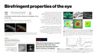 Birefringentpropertiesofthe eye
http://dx.doi.org/10.1167/iovs.03-1160
http://dx.doi.org/10.1016/j.preteyeres.2011.06.003
Example of tissue discrimination based on PS-OCT. (A) intensity image, (B) pseudo color coded
structural images. The light brown corresponds to conjunctiva, green indicates sclera, dark yellow
indicates trabecular meshwork, blue indicates cornea, and red indicates uvea. (reprinted from
Miyazawa et al. (2009)).
Different performances of RPE detection in a patient with neovascular AMD. (A)
Cirrus OCT (Zeiss Meditec), (B) Spectralis OCT (Heidelberg Engineering), (C) PS-
OCT. (D) Retinal thickness map (inner limiting membrane to RPE) retrieved from
Cirrus OCT, (E) retinal thickness map retrieved from Spectralis OCT, (F) retinal
thickness map obtained with PS-OCT (areas with RPE atrophy are marked in
gray). The arrows in (C) and (F) point to locations with RPE atrophy (reprinted
from Ahlers et al. (2010)).
...differentiation between different highly
backscattering layers is difficult because of the
heavily distorted retinal structure. Therefore, the
automated RPE segmentation provided by
commercial instruments often yields erroneous
results (c.f. bottom red B). Moreover, the
commercially available RPE detection algorithms fail
to detect RPE atrophies. Since RPE segmentation
using PS-OCT data is based on an intrinsic tissue
specific contrast, RPE atrophies can be detected
even in such a case of RPE distortion ©
Note the presence of multiple locations of RPE
atrophy that can only be detected with PS-OCT (c.f.
arrows in F). These atrophies might give an
explanation why in these patients after restoration
of retinal anatomy that is visible in OCT B-scans (e.g.
after antiangiogenic treatment) the visual acuity is
not improved - Ahlers et al., 2010.
Thickness (dotted line) and birefringence (solid line) plots of an area temporal (A) and superior (B) to the ONH.
DPPR data belonging to the RNFL is fit with a least-squares linear fit. The slope in the equation represents the
DPPR/UD or birefringence. The vertical lineindicates the boundary of the RNFL, as determined from the intensity
and DPPR data. In (A), the increase in DPPR at a depth beyond 450 μm is caused by either a relatively low signal-
to-noise ratio, or by the presence of a highly birefringent material—for instance, collagen in the sclera.
 