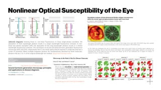 NonlinearOpticalSusceptibilityof the Eye
Jablonski diagrams showing linear vs. non-linear fluorescence. In linear single-photon excitation, the
absorption of short wavelength photons results in a longer wavelength fluorescence emission. In non-
linear two-photon excitation (2PE), the absorption of two long wavelength photons results in a shorter
wavelength fluorescence emission. The techniques of second and third harmonic generation fluorescence
microscopy (SHG and THG, respectively) elicit a non-linear optical (NLO) response in molecules that lack a
center of symmetry. When multiple longwave photons are simultaneously absorbed by these molecules,
photons that are ½ or ⅓ of the original wavelength are emitted. alluxa.com/learning-center
http://dx.doi.org/10.1002/lpor.200910024
We are also using two-photon and single harmonic generation with
confocal imaging to investigate the extracellular attachments between
the trabecular meshwork and Schlemm's canal. These recent studies
show a decrease in elastin near the base of Schlemm's canal
glaucoma eyes which may affect the mechano-sensitive environment
and disrupt outflow. In conclusion, we are utilizing multiple imaging
modalities to answer questions regarding fluid flow patterns, local
and global relationships within the eye, and morphological changes
that occur in glaucoma.
https://doi.org/10.1017/S1431927616006814
(a) A typical PFO/DOFA map of a human ONH. (b) A typical SHG image of the same ONH. PFO/DOFA maps were overlaid
and aligned with SHG images to allow identification of the scleral canal margin in PFO/DOFA maps.
(c) The ONH was subdivided into: the LC, terminating at the edge of the scleral canal; an insertion region, defined as an
annular ring extending 150 mm from the scleral canal margin; and a peripapillary scleral region, defined as an annular ring
extending from 150 to 1000 mm from the scleral canal margin. (d) The LC was subdivided into 12 regions for analysis. S,
superior; N, nasal; I, inferior; T, temporal.
 