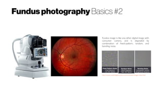 Fundusphotography Basics #2
Fundus image is like any other digital image with
consumer camera, and is degraded by
combination of fixed-pattern, random, and
banding noise.
http://www.cambridgeincolour.com/tutorials/image-noise.htm
 
