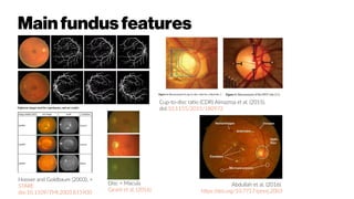 Mainfundusfeatures
Cup-to-disc ratio (CDR) Almazroa et al. (2015).
doi:10.1155/2015/180972
Hoover and Goldbaum (2003), +
STARE
doi:10.1109/TMI.2003.815900
Abdullah et al. (2016)
https://doi.org/10.7717/peerj.2003
Disc + Macula
Girard et al. (2016)
 