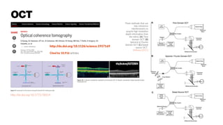 http://dx.doi.org/10.5772/58314
http://dx.doi.org/10.5772/58314
Three methods that use
low coherence
interferometry to
acquire high resolution
depth information from
the retina. (A) Time
domain OCT. (B)
Spectral or Fourier
domain OCT. (C) Swept
source OCT.
Williams (2011)
http://dx.doi.org/10.1126/science.1957169
Cited by 10,916 articles
OCT
 