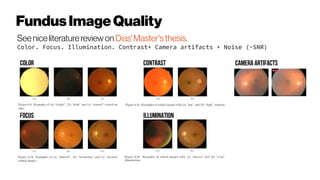 FundusImageQuality
Seeniceliteraturereviewon Dias'Master'sthesis.
Color. Focus. Illumination. Contrast+ Camera artifacts + Noise (~SNR)
COLOR
FOCUS
CONTRAST
ILLUMINATION
CAMERA Artifacts
 