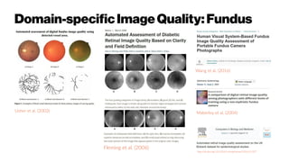 Domain-specificImageQuality:Fundus
Usher et al. (2003) Maberley et al. (2004)
Fleming et al. (2006)
http://dx.doi.org/10.1016/j.compbiomed.2016.01.027
Wang et al. (2016)
 