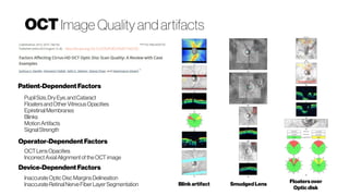 http://dx.doi.org/10.1155%2F2015%2F746150
Blinkartifact SmudgedLens
Floatersover
Opticdisk
Patient-DependentFactors
Operator-Dependent Factors
Device-DependentFactors
PupilSize,DryEye,andCataract
FloatersandOtherVitreousOpacities
EpiretinalMembranes
Blinks
MotionArtifacts
SignalStrength
OCTLensOpacities
IncorrectAxialAlignmentoftheOCT image
InaccurateOpticDiscMarginsDelineation
InaccurateRetinalNerveFiberLayerSegmentation
OCT Image Quality and artifacts
 