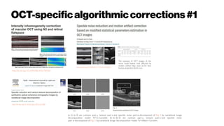 OCT-specific algorithmiccorrections#1
http://dx.doi.org/10.1109/ISBI.2016.749324
The example of OCT images of the
nerve head (below row) affected by
motion artifact (top row). (a) En face
fundus projection (b) B-scan.
http://dx.doi.org/10.1088/2057-1976/2/3/035012
http://dx.doi.org/10.1016/j.ijleo.2016.05.088
(a-1)–(a-3) are cartoon part u, texture part v and speckle noise part w decomposed of Fig. 1 by variational image
decomposition model TV-G-Curvelet; (b-1)–(b-3) are cartoon part u, texture part v and speckle noise
part w decomposed of Fig. 1 by variational image decomposition model TV-Hilbert-Curvelet.
 