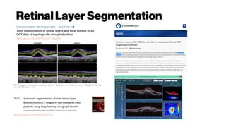 RetinalLayerSegmentation
https://doi.org/10.1109/TMI.2017.2666045
https://doi.org/10.1364/BOE.8.002732
 