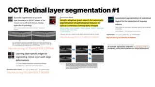 OCT Retinallayersegmentation#1
http://dx.doi.org/10.1364%2FBOE.5.000348
http://dx.doi.org/10.1117/1.JBO.21.7.076015 http://dx.doi.org/10.1364/AO.55.000454
http://dx.doi.org/10.1142/S
1793545816500085
http://dx.doi.org/10.1364/BOE.7.002888
 
