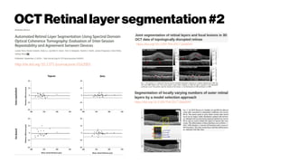 OCT Retinallayersegmentation#2
http://dx.doi.org/10.1371/journal.pone.0162001
https://doi.org/10.1109/TMI.2017.2666045
https://doi.org/10.1109/TMI.2017.2666044
 