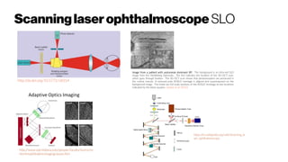 Scanninglaserophthalmoscope SLO
http://dx.doi.org/10.5772/58314
Image from a patient with autosomal dominant RP. The background is an infra-red SLO
image from the Heidelberg Spectralis. The line indicates the location of the SD-OCT scan,
which goes through fixation. The SD-OCT scan shows that photoreceptors are preserved in
the central macula A reduced-scale AOSLO montage is aligned and superimposed on the
background image. The insets are full scale-sections of the AOSLO montage at two locations
indicated by the black squares. Godara et al. (2010)
 