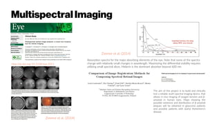 MultispectralImaging
http://dx.doi.org/10.1038/eye.2011
.202
Absorption spectra for the major absorbing elements of the eye. Note that some of the spectra
change with relatively small changes in wavelength. Maximizing the differential visibility requires
utilizing small spectral slices. Melanin is the dominant absorber beyond 600 nm.
Zimmer et al. (2014)
Zimmer et al. (2014)
The aim of this project is to build and clinically
test a reliable multi-spectral imaging device, that
allows in vivo imaging of oxygen tension and β-
amyloid in human eyes. Maps showing the
possible existence and distribution of β-amyloid
plaques will be obtained in glaucoma patients
and possibly patients with (early) Alzheimers’s
disease.
 