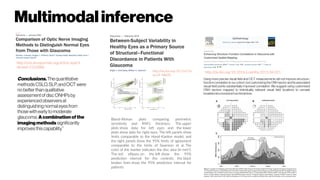 http://iovs.arvojournals.org/article.aspx?a
rticleid=2122880
Conclusions. Thequantitative
methodsCSLO,SLP,andOCT were
no betterthanqualitative
assessmentofdiscONHPsby
experiencedobserversat
distinguishing normal eyesfrom
those with earlytomoderate
glaucoma. Acombinationofthe
imagingmethods significantly
improvesthiscapability.”
Using more precise visual field and OCT measurements did not improve structure–
function correlation in our cohort, but customizingthe ONH sector and itsassociated
visual field points substantially improved correlation. We suggest using customized
ONH sectors mapped to individually relevant visual field locations to unmask
localized structural and functional loss.
http://dx.doi.org/10.1016/j.ophtha.2015.04.021http://dx.doi.org/10.1167/io
Bland-Altman plots comparing perimetric
sensitivity and RNFL thickness. The upper
plots show data for left eyes and the lower
plots show data for right eyes. The left panels show
limits comparable to the Hood-Kardon model, and
the right panels show the 95% limits of agreement
comparable to the limits of Swanson et al. The
color of the marker indicates the disc area (in mm2
).
The red ellipses on the left show the 95%
prediction interval for the controls; the black
broken lines show the 95% prediction interval for
patients
Multimodalinference
 