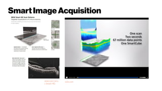 SmartImageAcquisition
zeiss.com Cirru
s Smart HD
zeiss.com
 