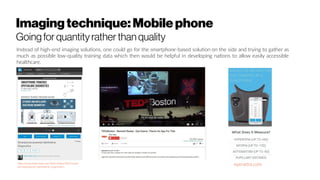 Imaging technique:Mobile phone
Goingfor quantity ratherthan quality
Instead of high-end imaging solutions, one could go for the smartphone-based solution on the side and trying to gather as
much as possible low-quality training data which then would be helpful in developing nations to allow easily accessible
healthcare.
eyenetra.comhttp://www.slideshare.net/PetteriTeikariPhD/smart
phonepowered-ophthalmic-diagnostics
 