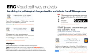 ERGVisual pathway analysis
Localizingthepathologicalchangesin retinaandinbrainfromERGresponses
http://dx.doi.org/10.1016/S1350-9462(00)00030-6
“The tendency for large fibers to be lost in glaucoma has implications
for future improvements in testing for early glaucoma damage.”
year 1987, http://iovs.arvojournals.org/article.aspx?articleid=2177694
http://dx.doi.org/10.1016/j.jpsychires.2015.09.003
Highlights
• Retinalelectrophysiologicalabnormalitieswereobservedindepression.
• Flashelectroretinogrammayservetomonitordrugresponsein depressed patients.
• Patternelectroretinogrammaybeusedtodifferentiatedepressedpatientsandcontrols.
• Retinalelectrophysiologicalmeasurementsmightreflect thepathophysiologyofdepression.
http://dx.doi.org/10.1016/j.biopsych.2012.11.024
 