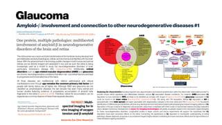 Glaucoma
Amyloid-binvolvementandconnectiontootherneurodegenerativediseases#1
http://dx.doi.org/10.1007/s00018-016-2348-1
http://dx.doi.org/10.1007/s00018-016-2295-x
The retina arises as a neuro-ectodermal derivative of the forebrain duringdevelopment
and delineates several physiological, cellular and biochemical similarities with the brain
tissue. With the advancement in technology, subtle changes in both human and animal
retinas can be directly imaged and assessed in vivo and as such the retina is being
increasingly used as a model to study the neurodegenerative disorders of brain
particularly Alzheimer’s disease (AD, Guptaet al. 2016). Additionally, retinal
disorders such as age-related macular degeneration (AMD) and glaucoma
are chronic neurodegenerative conditions that affect vari- ous retinal neurons and lead
toprogressive and irreversible lossofthe vision.
All three diseases are multifactorial with distinct pathological and clinical
manifestations even though age remains the common primary risk factor and
people with family history are at higher risk. Although AMD and glaucoma are not
classified as amyloidogenic diseases, the last decade has seen many animal and
human studies featuring evidence of progressive accumulation of amyloid beta
fragments in the retina (Guptaet al. 2014). Therefore, retinal Ab accumulation can be
regarded asacommon feature ofthese three separatedisorders
Analysing Ab characteristics including fragment size, oligomerisation and anatomical distribution within the retina holds ‘‘reasonable promise’’ to
provide unique retinal signatures and differentiate between various Ab associated disease conditions. For instance, AMD-associated Ab
deposition is more restricted to RPE and likely to be identified as complex with drusen (Anderson etal. 2004). In glaucoma, expression of Ab
could be found in the inner retina (Guo etal. 2007; Guptaetal. 2014)[5, 39] along with ON excavation. Retinal Ab deposition in AD is
geographically more wide spread and again associated with degenerative changes in the inner retina and ON (Gupta etal. 2016). Successful
identification of differences and similarities will drive drug development and mechanism based pathophysiological research.Imaging patterns of Ab
deposition in the eye could be of diagnostic and prognostic value when considered with other ocular or biochemical markers and play imperative
role in disease monitoring. Development of newer Ab imaging technologies will greatly accelerate research into mechanism based therapies
for these neurodegenerative disorders. Longitudinal studies in larger cohorts and rescue experiments will support the hypothesis that Ab
deposition does exert neurotoxic effects on the retina. Concluding, the significance of Ab depostion in mechanistic understanding of retinal
pathology, diseasediagnosis, prognosis or as a treatment target is highly relevant considering its known neurotoxic effects and the high incidenceof
thesediseasesinageing populations.
PhD Project: Multi-
spectral imaging for in
vivo imaging of oxygen
tension and β-amyloid
University Eye Clinic Maastricht
 
