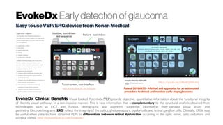 EvokeDx Early detection of glaucoma
EasytouseVEP/ERGdevicefromKonanMedical
https://youtu.be/DRoXQPJ9cbU
EvokeDx Clinical Benefits Visual Evoked Potentials (VEP) provide objective, quantitative information about the functional integrity
of discrete visual pathways in a non-invasive manner. This is new information that is complementary to the structural analysis obtained from
technologies such as OCT and Fundus photography, and augments subjective information from standard visual acuity and
perimetry. Electroretinograms (ERG) reflect the integrity of the optics, photoreceptors, bipolar cells and retinal ganglion cells. Clinically, ERGs may
be useful when patients have abnormal VEPs to differentiate between retinal dysfunction occurring in the optic nerve, optic radiations and
occipital cortex. http://konanmedical.com/evokedx/
http://konanmedical.com/evokedx/ Patent 06966650 - Method and apparatus for an automated
procedure to detect and monitor early-stage glaucoma
 
