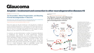 Glaucoma
Amyloid-binvolvementandconnectiontootherneurodegenerativediseases#2
http://dx.doi.org/10.1523/JNEUROSCI.3986-15.2016
Recent work supports the idea that neuronal loss in AD and glaucoma is mediated by
common neurodegenerative pathways. For example, A accumulation has been observed in
experimental glaucoma (McKinnon et al., 2002; Goldblum et al., 2007; Kipfer-Kauer et al.,
2010; Ito et al., 2012), and blockade of the A pathway reduced RGC loss (Guo et al., 2007;
Salt et al., 2014). It is increasingly recognized that tau is a key mediator of A toxicity
(Rapoport et al., 2002; Santacruz et al., 2005; Roberson et al., 2007).
In summary, our data demonstrate a number of important alterations
in endogenous tau induced by ocular hypertension, including
phosphorylation, oligomerization, and accumulation in RGC dendrites.
These pathological changes contribute to neurodegeneration because
reducing tau burden promoted substantial protection of RGC somas
and axons from glaucomatous damage. These results reveal that
glaucoma shares key common features with tauopathies, and identify
tau as a novel therapeutic target to potentially counter RGC
neurodegeneration in glaucoma and other optic neuropathies.
 
