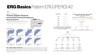 ERGBasics Pattern ERG (PERG) #2
...
http://dx.doi.org/10.1167/iovs.12-11201
ROC of PhNR amplitude and PERG ratio. (A) Preperimetric glaucoma. (B) Manifest glaucoma. The shaded
areas indicate the confidence interval (CI) for the ROC curve; the value of the AUC and its 95% CI are given
under the 45° line. Three main aspects can be seen: (1) AUC increases from preperimetric to manifest
glaucoma, (2) for both PhNR or PERG, AUC is higher for ratios than for raw amplitudes, (3) PhNR and PERG
perform rather similarly.
“ThePhNRhasthe
advantageofnotrequiring
clearopticsandrefractive
correction;thePERGhas
theadvantageofbeing
recordedwithnatural
pupils.”
 