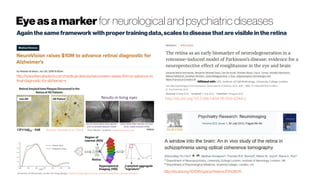 Eyeasamarker for neurological and psychiatric diseases
Again thesameframework withproper trainingdata,scalesto diseasethatarevisiblein theretina
http://www.fiercebiotech.com/medical-devices/neurovision-raises-10m-to-advance-re
tinal-diagnostic-for-alzheimer-s
http://dx.doi.org/10.1186/s40478-016-0346-z
Affiliated with: UCL Institute of Ophthalmology, University College London
http://dx.doi.org/10.1016/j.pscychresns.2011.08.011
Koronyo-Hamaoui et al. (2012) Prof Melanie Campbell motherboard.vice.com
University of Minnesota: Center for Drug Design | https://drugdesign.umn.edu/research/alzheimers-disease-research
 