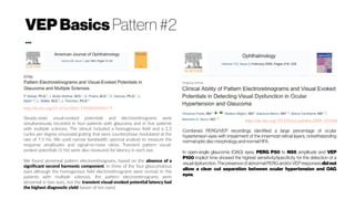 VEPBasics Pattern #2
...
http://dx.doi.org/10.1016/0002-9394(83)90457-9
Steady-state visual-evoked potentials and electroretinograms were
simultaneously recorded in four patients with glaucoma and in five patients
with multiple sclerosis. The stimuli included a homogenous field and a 2.3
cycles per degree sinusoidal grating that were counterphase modulated at the
rate of 7.5 Hz. We used narrow bandwidth spectral analysis to measure the
response amplitudes and signal-to-noise ratios. Transient pattern visual-
evoked potentials (1 Hz) were also measured for latency in each eye.
We found abnormal pattern electroretinograms, based on the absence of a
significant second harmonic component, in three of the four glaucomatous
eyes although the homogenous field electroretinograms were normal. In the
patients with multiple sclerosis, the pattern electroretinograms were
abnormal in two eyes, but the transient visual-evoked potential latency had
the highest diagnostic yield (seven of ten eyes).
http://dx.doi.org/10.1016/j.ophtha.2005.10.044
Combined PERG/VEP recordings identified a large percentage of ocular
hypertension eyes with impairment of the innermost retinal layers, notwithstanding
normal opticdisc morphologyandnormalHFA.
In open-angle glaucoma (OAG) eyes, PERG P50 to N95 amplitude and VEP
P100 implicit time showed the highest sensitivity/specificity for the detection of a
visual dysfunction. The presence ofabnormal PERG and/or VEP responses did not
allow a clear cut separation between ocular hypertension and OAG
eyes.
 