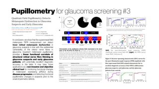 Pupillometry for glaucoma screening #3
http://dx.doi.org/10.1038/srep33373
Characteristics of the pupillometry stimulus fields represented in the visual
space of the left (test) eye (Panel A). Schematic of the pupillometry protocol
(Panel B). The pulse and sinusoidal stimulus protocols indicated by arrows were
common for blue and red stimuli. Blue stimuli (blue rectangles) and red stimuli (red
rectangles) were alternated and measurements were repeated twice. The double
slashes indicate a two-minute interval between the tests to allow the pupil return
to the baseline size39. PRE, pre-stimulus; PIPR, post-illumination pupil response;
SNF, superonasal field; INF, inferonasal field.
(left) the post-illumination pupil response (PIPR)
amplitude versus visual field MD (right), the PIPR versus
mean RNFL thickness (C
In conclusion, we show that the superonasal field
melanopsin PIPR measurement can detect
inner retinal melanopsin dysfunction in
glaucoma suspects in line with the preferential
vulnerability of the inferior nerve fibres in
glaucoma. Quadrant melanopsin pupillometry
provides a linear functional correlate of
structural retinal nerve fibre thinning in
glaucoma suspects and early glaucoma
patients, with potentially excellent diagnostic
accuracy in the latter. It may have future
applications as a non-invasive and objective
clinical tool for monitoring functional changes
in melanopsin expressing ipRGCs during
disease progression, and detecting functional
pupillometric changes in suspects prior to the
onset ofperimetric deficits.
 