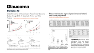 Glaucoma
Statistics#2
http://dx.doi.org/10.1016/j.ophtha.2014.05.013, Cited by274 articles
http://dx.doi.org/10.1136/bjophthalmol-2014-306102
Conclusions Across the Asian
subregions, there was greater
glaucoma burden in South-
Central and East Asia. Sustainable
public health strategies to combat
glaucoma in Asia are needed.
 