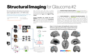 Structural Imaging for Glaucoma #2
http://dx.doi.org/10.1038/srep18969
While volume-based analysis (VBA) showed no significant
differences in the gray matter volumes of patients, surface-based
analysis (SBA) revealed significantly reduced cortical thickness in
the right frontal pole and ROI-based analysis volume shrinkage in
lateral geniculate nucleus (LGN) bilaterally, right V1 and left
amygdala.
Structural abnormalities were correlated with clinical
parameters in a subset of the patients revealing that the left LGN
volume was negatively correlated with bilateral cup-to-disk ratio
(CDR), the right LGN volume was positively correlated with the
mean deviation of the right visual hemifield, and the right V1
cortical thickness was negatively correlated with the right CDR in
glaucoma.
In fact, emotional changes in glaucoma patients have been reported before23,24
,
but we are the first to report volume atrophy in the amygdala in glaucoma which
may explain why patients tend to be more anxious and easily experience anger23
,
24.
Indeed, memory impairments were reported in some glaucoma patients25
. This
is why we also analyzed the hippocampus to more fully grasp the
neurobiological basis of psychological changes beyond visual perception in
glaucoma. However, our morphometric analysis did not reveal any significant
alterations of the hippocampus when glaucoma patients were compared to
normal controls. As the previous study25
pointed out that memory impairment
was found in only approximately 20% of the glaucoma patients, our sample size
may be too small to reveal any hippocampus volume differences.
 