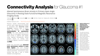 ConnectivityAnalysis for Glaucoma #1
http://dx.doi.org/10.1371/journal.pone.0089493
Previous studies demonstrated that
primary open angle glaucoma (POAG)
is associated with abnormal brain
structure; however, little is known
about the changes in the local
synchronization of spontaneous
activity. The main objective of this
study was to investigate spontaneous
brain activity in patients with POAG
using regional homogeneity (ReHo)
analysis based on resting state
functional magnetic resonance imaging
(rs-fMRI).
POAG was associated with abnormal
brain spontaneous activity in some
brain regions and such changed
regional activity may be associated with
clinical parameters. Spontaneous brain
activity may play a role in POAG
initiation and progression.
Significant differences of
spontaneous brain
activity between the
POAG group and normal
control group (p<0.05
with AlphaSim
correction).
The right dorsal anterior
cingulate, bilateral medial
superior frontal gyrus,
bilateral medial frontal
gyrus and right cerebellum
anterior lobe showed
increased spontaneous
brain activity in POAG
group (red). The bilateral
calcarine, right lingual
gyrus, bilateral precuneus
gyrus, left cerebellum
posterior lobe, left inferior
parietal lobule, bilateral
precentral and postcentral
gyrus showed decreased
spontaneous brain activity
in POAG group (blue).
 