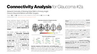 ConnectivityAnalysis for Glaucoma #2a
http://dx.doi.org/10.1371/journal.pone.0141389
Using voxel-wise degree centrality (DC),
as measured by resting-state fMRI, we
aimed to study alterations in the brain
functional networks in patients with
primary angle-closure glaucoma (PACG)
and to reveal the plastic trajectories of
surgery.
Our results suggest that PACG may
contribute to decreased functional
centrality in the visual system and to
increased degree centrality in cognition-
emotional processing regions. Alterations
in visual areas seem to parallel the cup
to disc ratio, but not the duration of
angle closure. The changes of functional
centrality in PACG patients after
operation may reveal the plasticity or
degeneration of the visual-associated
brain areas. Our findings may provide
further understanding of the
pathophysiology of PACG.
Voxel-wise comparison of DC between Post- and Pre-PACG patients. Areas of
significant (p < 0.05, GRF corrected) DC difference between Post- and Pre-PACG
patients. Hot (cool) color represents higher (lower) DC in the Post-PACG group
compared with the Pre-PACG group. a) Axial view and b) DC values of significant
different clusters (left MOG and right cuneus and left precentral gyrus) between Post-
and Pre-PACG patients. Abbreviation: MOG, middle occipital gyrus.
Degree centrality (DC) can be considered the ability for information
integration, and high DC may serve as a hub for the traffic operation of
functional networks, superior information propagation and may thus
contribute to efficient information flow[23,37]
. In this framework, the decreased
DC of the bilateral visual cortices observed in our study may be an
expression of decreased visual sensory information input and degenerative
“hubness” associated with PACG. Vision loss or eye conditions related to
changes in cortical thickness[12,40,41]
, density, and volume[11,42,43]
have been
observed in humans associated with both POAG and blindness.
In addition to decreased DC in the visual cortex, we found significant
increased DC in the anterior cingulate cortex (ACC) and caudate. Because of
a lack of mood ratings, this finding suggests the necessity for assessing the
mood scale for use as covariates when investigating brain alterations in
glaucomatous populations, as previous research has suggested a higher
prevalence of anxiety and depression in primary glaucoma patients,
especially in PACG patients in China[52,53]
. The caudate, along with the
putamen and globus pallidus, makes up the basal ganglia and is implicated in a
range of functions, including the regulation of cortical excitability and sensory
processing[54]
. Glaucoma patients are frequently reported to have impaired
proprioception under somatosensory perturbations[55,56,57]
.
Interestingly, we tentatively examined the postoperative transformation of
DC to test the neuroplastic trajectories of surgery over 3 months and found
heightened DC in the visual cortex and primary sensory and
supplementary motor areas. This postoperative enhancement, accompanied
by postoperatively lower IOP and ease of symptoms, may indicate that the
postoperative plasticity of functional network centrality in the visual cortex
occurs and that this neuroplasticity underlies improved behaviors. Whereas
the glaucomatous changes in the visual pathway are generally considered
transsynaptic/anterograde degeneration[2,13]
, one possible explanation for
this result may be the restoration process. Carefully screening the patients,
we found six of the follow-up post-PACG patients had a sudden onset of
total angle closure; thus, there was not enough time to change profoundly.
 